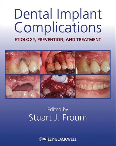 8 Dec 2010  Complications of Dental Implants: Identification, Frequency and  PPT; Health   Compliance Slides; Longitudinal scintigraphic study of parotid 