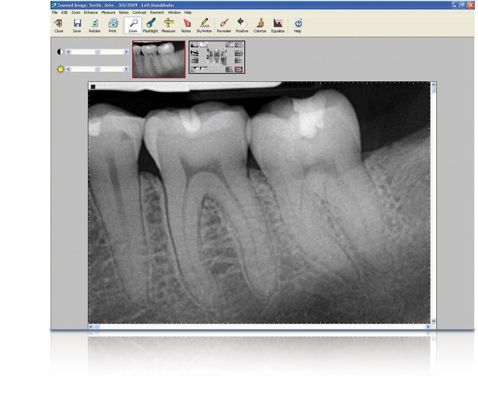 Dental X Ray Software – Find Local Dentist Near Your Area