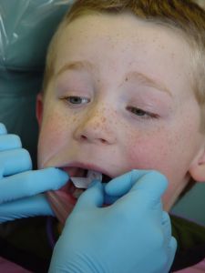 Children with disabilities often deal with special dental problems. For instance,   they are more likely to have gum disease than children without disabilities.