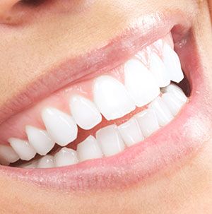 29 Jul 2009  Dental implants are one of the most expensive teeth treatments. Some clinics   even classify them as cosmetic procedures. Persons who do 