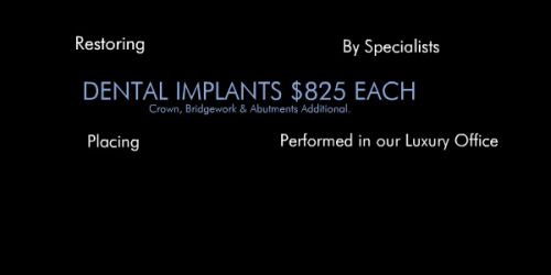 Dental Implants $825 Each! Bargain Priced Dental Implants Dental Implants at   the Bargain Price of $825! At Dental Implants USA we believe that everyone has 