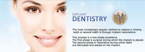 New Albany Adult Dentistry of Columbus, Ohio offers dental implants. Dr.   Johnson is the only dentist in Ohio offering ceramic implants.