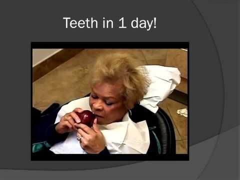 http://youtu.be/QVsJ7_SRVSY 7 wks & 4 days before the Dental Contest   Concluded. Believing in what you're striving for; One will not miss the mark. To   have a 
