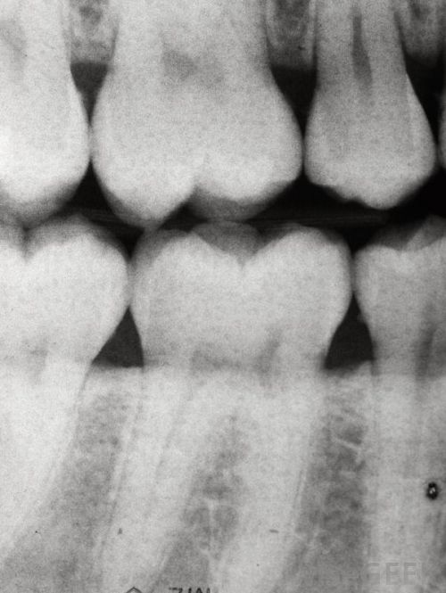 X-ray Laws. X-rays are often a part of dental exams, and while there is no   statutory direction as to how often a dentist must take X-rays, there is a general   liability 