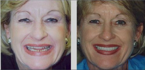 holistic dentistry for Columbia, SC. Find phone numbers, addresses, maps,   driving directions and reviews for holistic dentistry in Columbia, SC.
