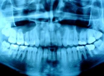 We are required by law to keep a patients original dental x-rays on file in our   office just as you would the patients dental records even if the 