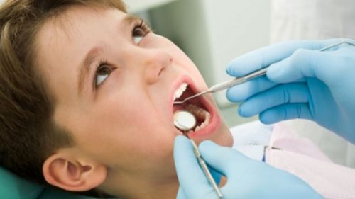 Medicaid covers extractions of the teeth, majority of 