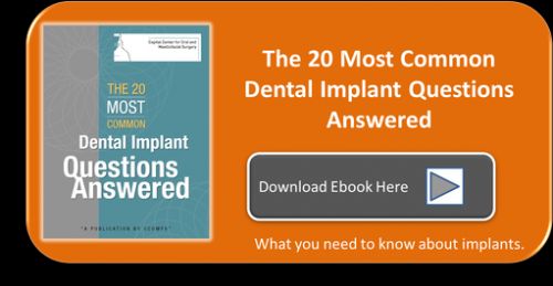 How Much Does a Dental Implant Cost? Fees from Dental Implants vary from   dentist to dentist. Always schedule an Implant Consultation to discuss the 