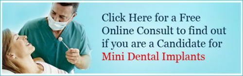 Dental Providers and/or members who wish to obtain benefit  ADA Current   Dental Terminology (CDT) procedure code  Mini-Implants and Implants (D6010  ) 