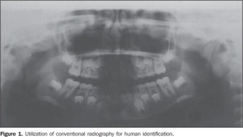Film processing procedures have a direct effect on the quality of a radiograph.    A photographic image is produced on dental x-ray film when it is exposed to .. is   maintained properly, there is less chance of errors during film processing.
