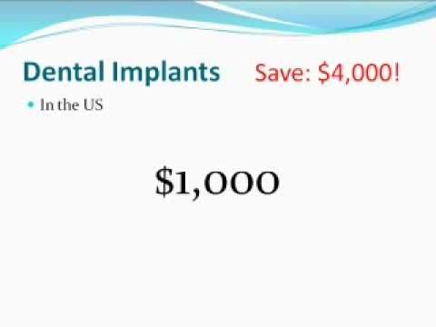 Average dental clinics in Canada charges 2500 to 3500 dollars per implant.   Though the price list says the implant priced at 800 dollars, but there are   additional 