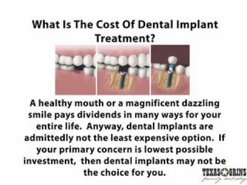 Rochester New York physician directory - Get information on dental implants,   replacement tooth  Learn about costs, recovery time and pain of the procedure.