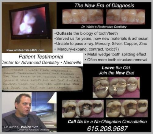 CAYCE DENTAL CLINIC 617 South  Walk-in emergency care (exams,   extractions, fillings and cleanings, Prev., Restorative, No Endo.)  Nashville, TN   37203 