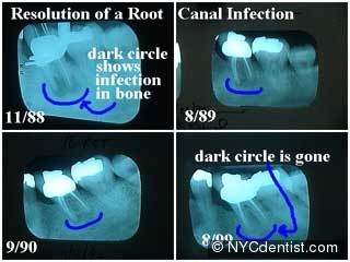 The dental x-ray specialist should be familiar with the common causes of faulty .   The landmarks that appear as dark areas on the film are radiolucent.