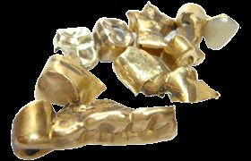 A Gold dental crown or a cap is a cover that is placed over a tooth to protect a    St Louis MO Lumineers St Louis MO Dentist Lumineers Dentist in St Louis MO.