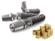 There are several reasons why dental implants in the UK are so much more   expensive than abroad. The main implant suppliers in the UK charge UK dentists 