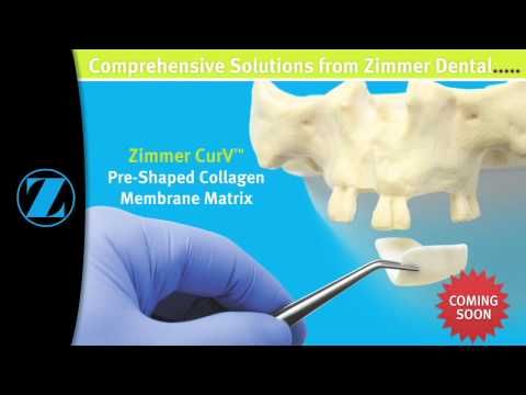 Zimmer Dental is a market leader in the development of world-class implantology   products and  Surgical Guide for Guided Surgery, TSV Implant System 