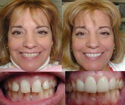 For the best cosmetic dentistry in New York and the world, experience the   expertise of New York cosmetic dentist Dr. Irwin Smigel. Deemed the father of 