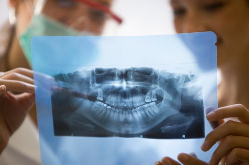 No preparation is needed for a dental x-ray and you  because metal causes an   artifact on the x-ray and  endeavour to book you in sooner (where possible).