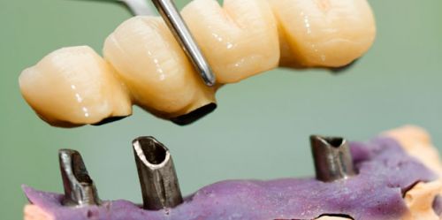 Reviews on Cheap dentist in Atlanta Ansley Midtown Dental, Mid City Dentistry,   Atlanta Dental Spa, Marvin Kaplan, DDS, Goldstein Garber & Salama Llc, Hiram 