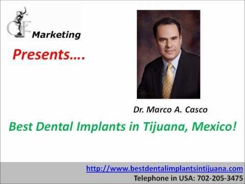 Dental Art International is the best place for Tijuana cosmetic dentistry, and   dental implants in Mexico. We have the lowest prices & highest quality.