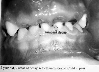 No matches for Medicaid Dentists in Wayne County - try 