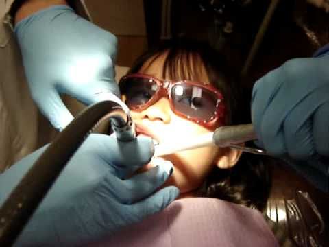 Atlanta Waterlase: For Atlanta Waterlase, No Drill Dentistry Atlanta, Waterlase   Dental Atlanta, Waterlase Dental Treatment, No Drill Dentistry visit Flax Dental.
