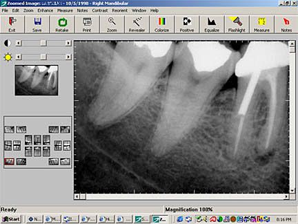 Digital radiography in dentistry provides the clinician with the ability to store their    a lot of different names (rebranding is quite usual for this type of product).