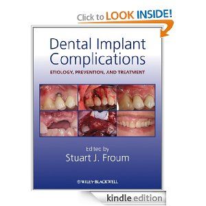 Dental Implant Complications Etiology Prevention And Treatment Pdf ...