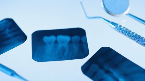 10 Apr 2012  Getting frequent dental X-rays appears to increase the risk for a commonly   diagnosed brain tumor, a new study finds.