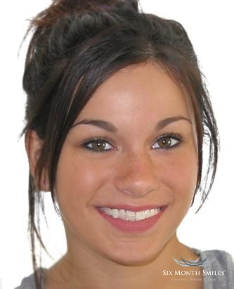 3 listings of Dentists in Fort Myers on YP.com. Find reviews, directions & phone   numbers for the best main street dental in Fort Myers, FL.