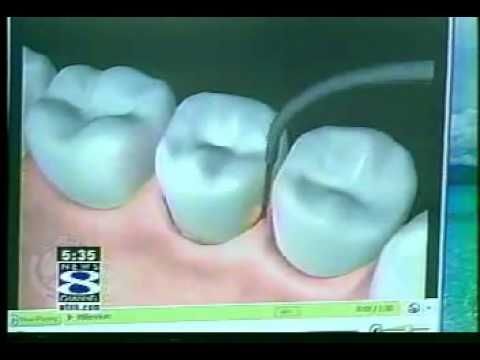 Dentist guide to find the right dental services in Phoenix, AZ.