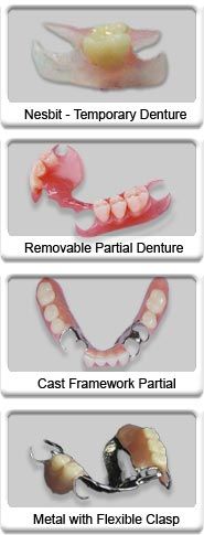 A removable partial denture or bridge usually consists of replacement teeth    Yes, dental implants can be used to support permanently cemented bridges, 
