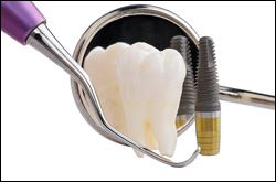 Cincinnati OH Oral Surgeon provides Surgical Instructions for After Placement of   Dental Implants, Dental Implant Surgery Home Care Instructions.
