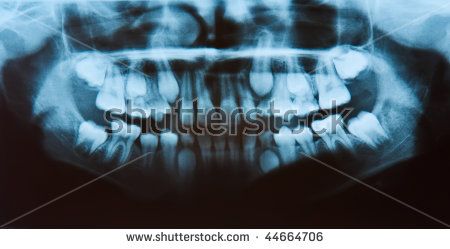 practical and user-friendly extraoral dental X-ray units.  of reference anatomical   landmarks  In order to achieve accurate and undistorted panoramic 
