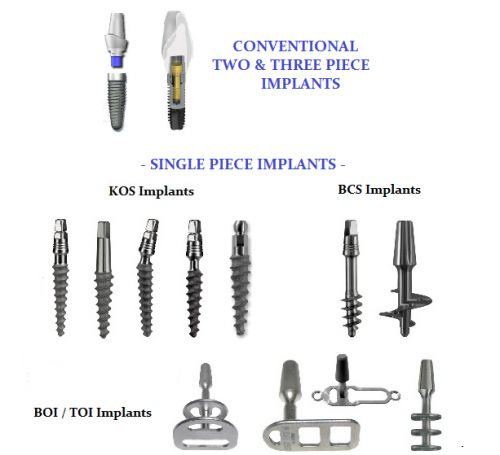 The wider use of bone grafts by dental implant dentists today has made possible   the use of alternative types such as endosseous or subperiosteal implants that 