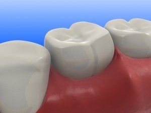Houston cosmetic dentists costs: Dr. Ka-Ron Wade has payment plans for   Houston cosmetic dentists costs. Review our Houston cosmetic dentists costs.