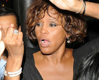 5 Apr 2012  The full autopsy report has been released for Whitney Houston, and  with a full   arch maxillary dental prosthesis supported by dental implants.