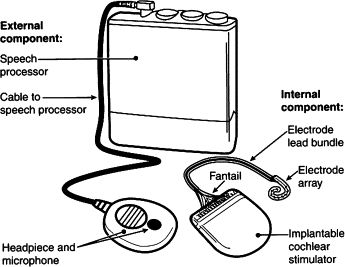 All cochlear implant users should read and understand the instructions given by    of professionals, including physiotherapists, nurses, chiropractors, dentists and    X rays can be undertaken but the speech processor should be switched off 