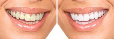 Find Queens, NY Dentists who accept 1199SEIU, See Reviews and Book Online   Instantly. It's free! All appointment times are guaranteed by our dentists and 