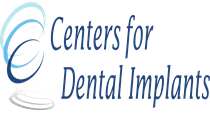 Center for Dental Implants