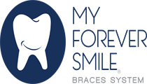 My Forever Smile Braces System